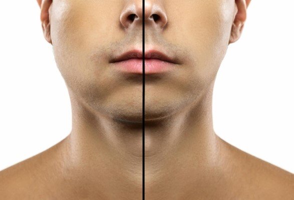 debloating method before and after
